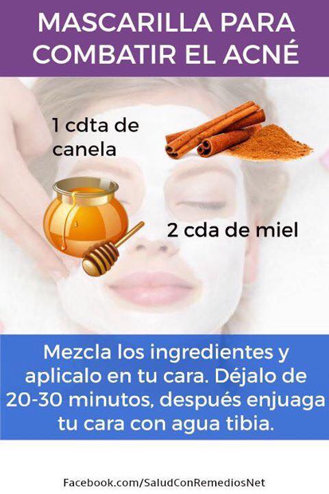 Mascarilla de Canela y Miel para Combatir el Acne de forma Natural