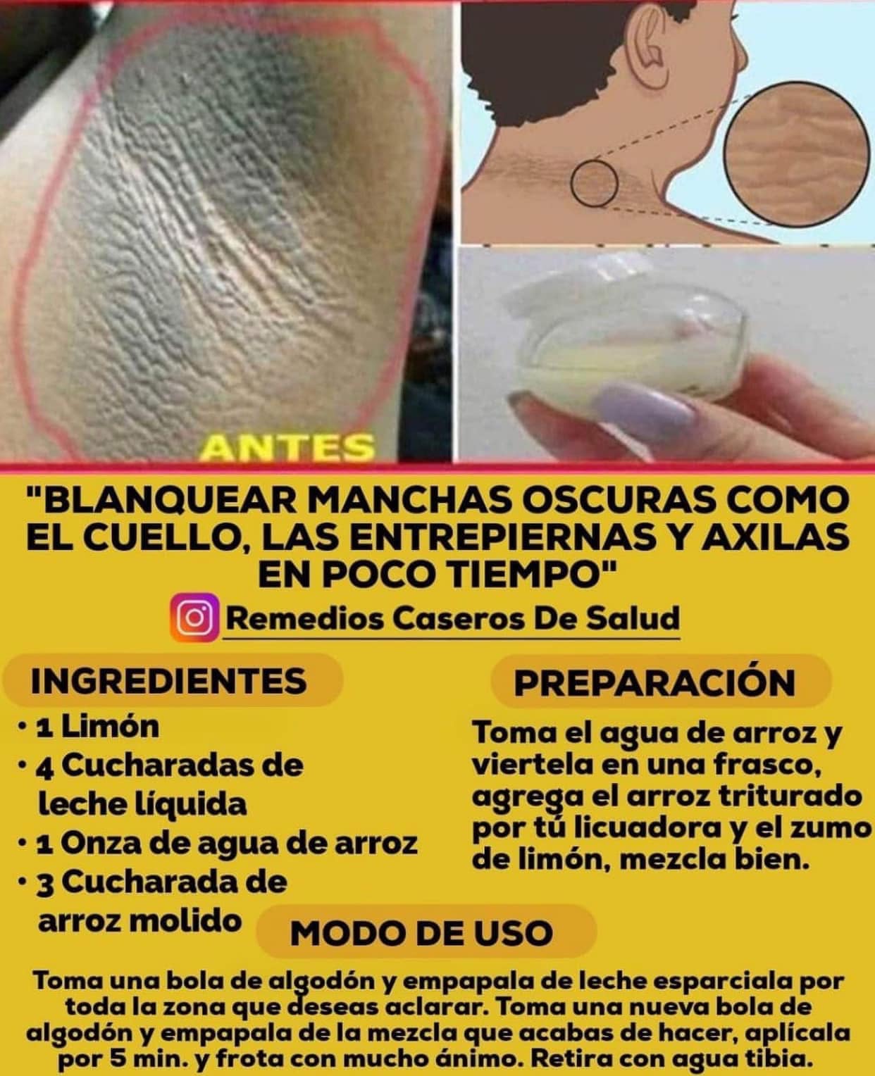 Remedio Natural para Blanquear Manchas Oscuras en la Piel