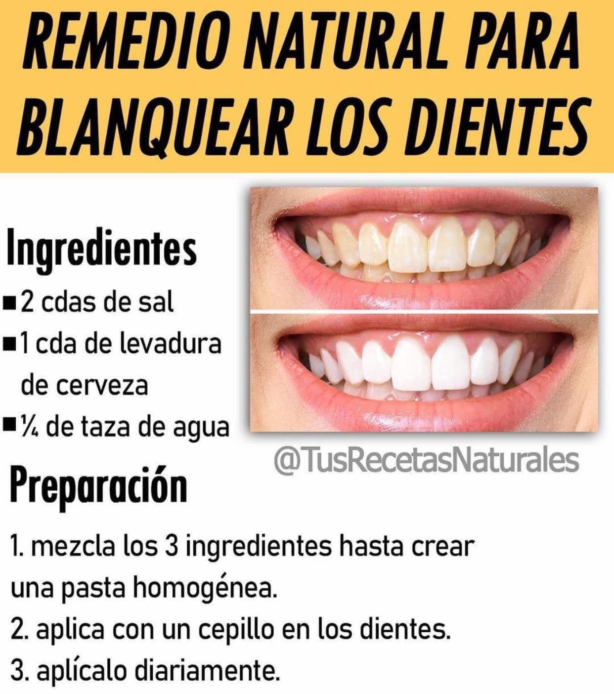 Remedio Natural para Blanquear los Dientes de Forma Efectiva